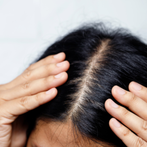 Signature Scalp Training Course